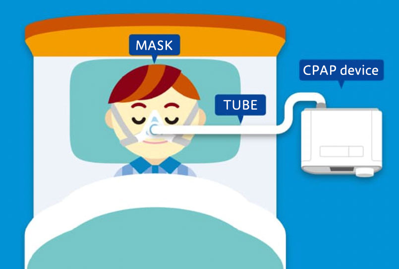 CPAP